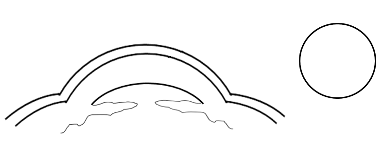 Cross section of the cornea back intact after PRK surgery. 