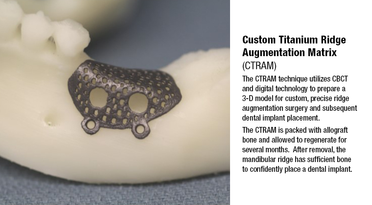 3D MAC model of a CTRAM